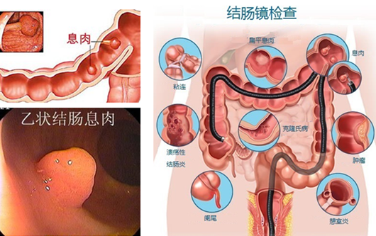 福清专门治疗肛肠疾病的医院？