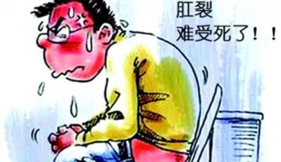 福清怎么治疗肛裂好