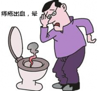 福清做痔疮的手术需要多少钱